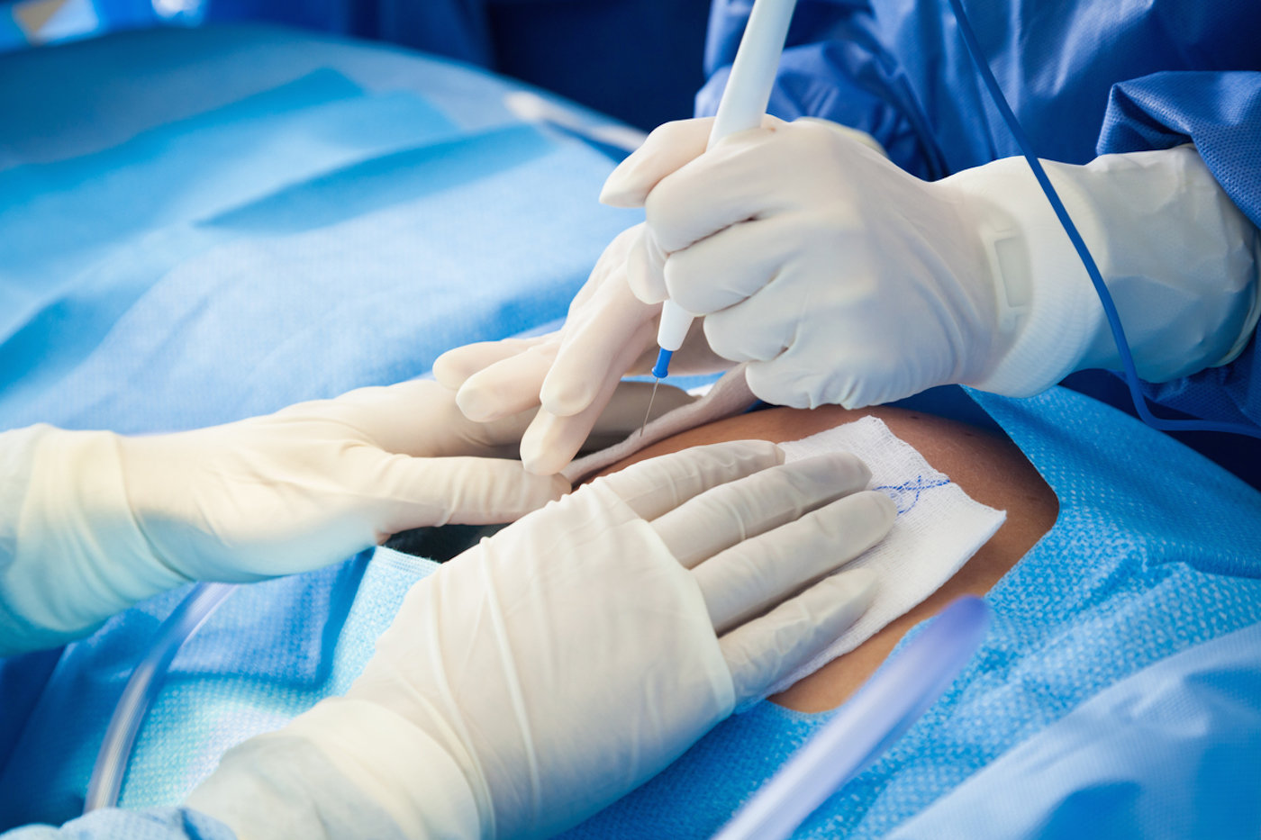 c-section c-section